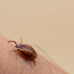 tick Removal